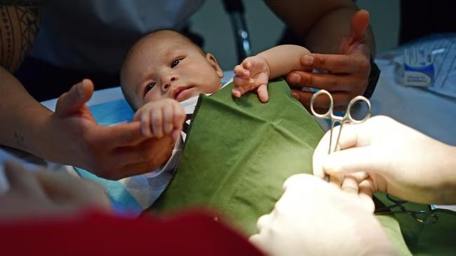 Circumcision Services